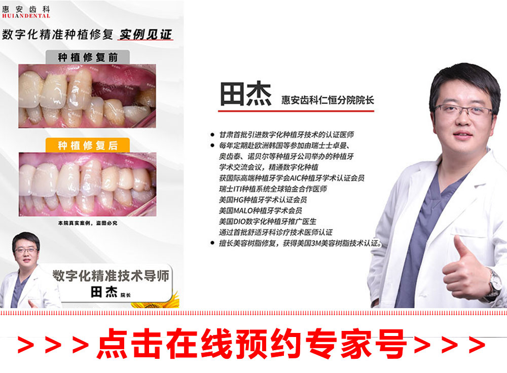 兰州惠安齿科医生，兰州惠安齿科种植专家，兰州惠安齿科种植医生，兰州种植牙医生